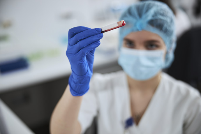 Técnico de laboratorio analizando sangre con neutrófilos segmentados altos.