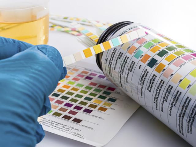 Prueba de cuerpos cetónicos en la orina sin diabetes.