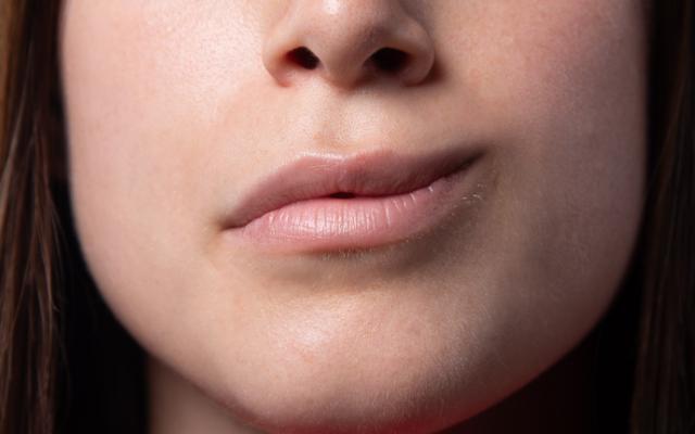 Mujer con la boca torcida, un síntoma para prevenir el ictus.