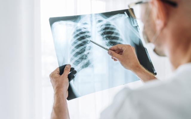 Médico revisa posibles manchas en los pulmones 